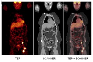 CHU-Amiens-Picardie_image-TEP-SCAN_2016